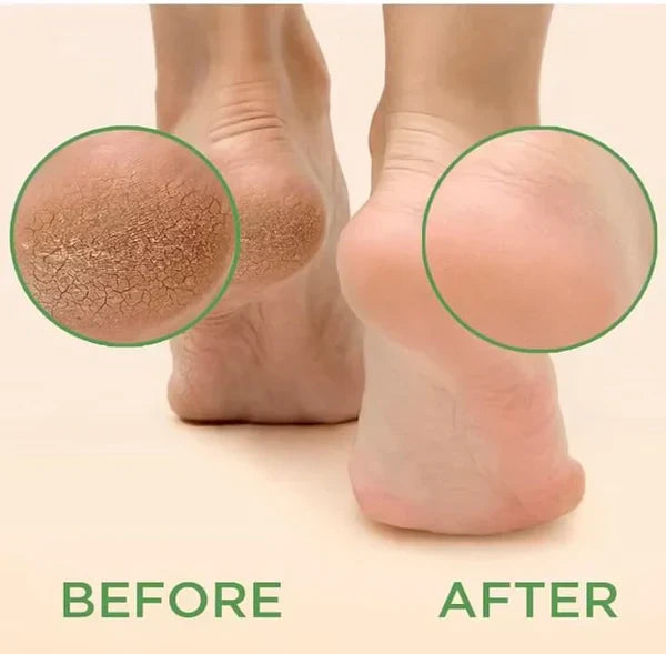 Masque Exfoliant pour les Pieds | Peaux Douces et Lisses